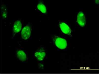 Immunocytochemistry/ Immunofluorescence: IFI16 Antibody (2E3) [H00003428-M03]
