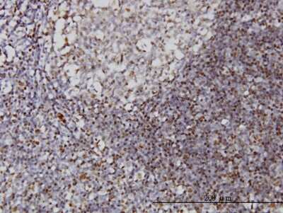 Immunohistochemistry-Paraffin: IFI16 Antibody (2E3) [H00003428-M03]