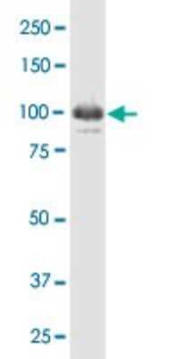 Western Blot: IFI16 Antibody (2E3) [H00003428-M03]