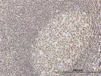 Immunohistochemistry-Paraffin: IFI16 Antibody (4E6) [H00003428-M04]