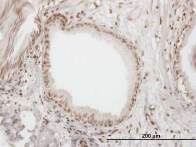 Immunohistochemistry-Paraffin: IFI16 Antibody (5C10) [H00003428-M06]