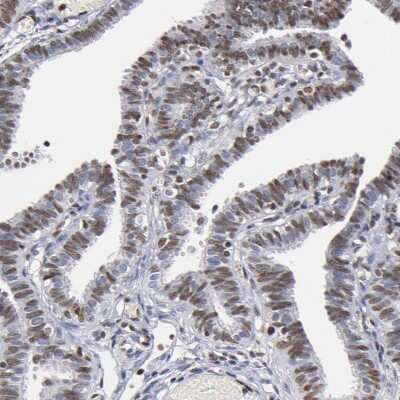 Immunohistochemistry-Paraffin: IFI16 Antibody [NBP1-83118]