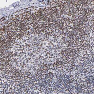 Immunohistochemistry-Paraffin: IFI16 Antibody [NBP1-83118]