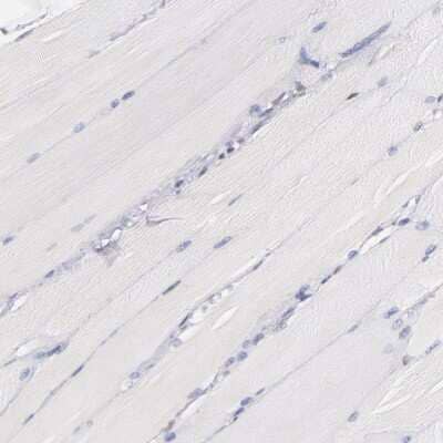 Immunohistochemistry-Paraffin: IFI16 Antibody [NBP1-83118]