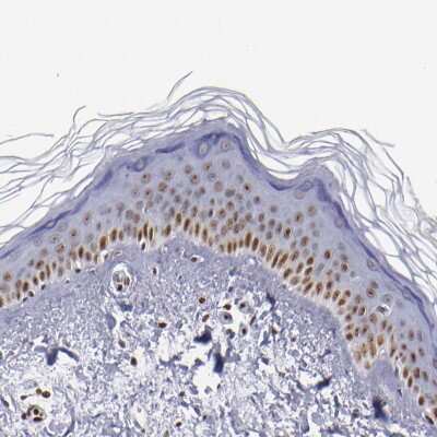 Immunohistochemistry-Paraffin: IFI16 Antibody [NBP1-83118]
