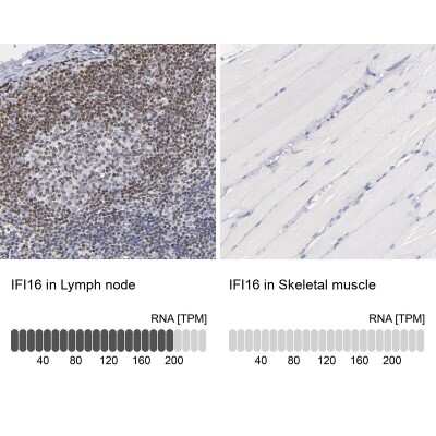 Immunohistochemistry-Paraffin: IFI16 Antibody [NBP1-83118]