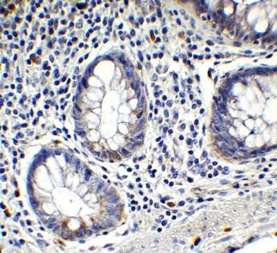 Immunohistochemistry-Paraffin: IFI16 Antibody - BSA Free [NBP3-18336]