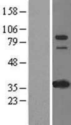 Western Blot: IFI16 Overexpression Lysate [NBL1-11826]