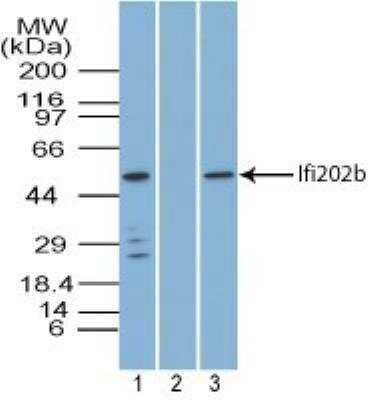 Western Blot: IFI202b Antibody [NBP2-27066]