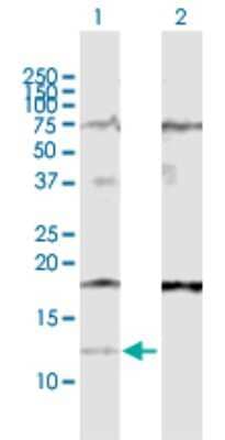 Western Blot: IFI27 Antibody [H00003429-D01P]