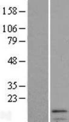 Western Blot: IFI27 Overexpression Lysate [NBL1-11827]