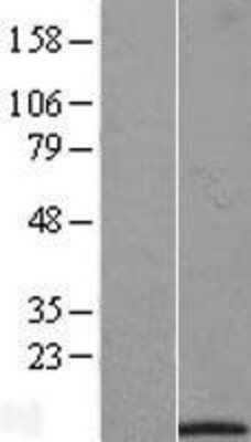 Western Blot: IFI27L1 Overexpression Lysate [NBL1-10481]