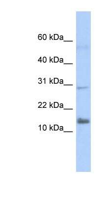 Western Blot: IFI27L2 Antibody [NBP1-62269]