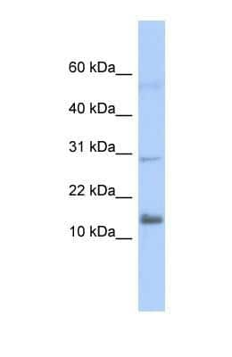 Western Blot: IFI27L2 Antibody [NBP1-69301]