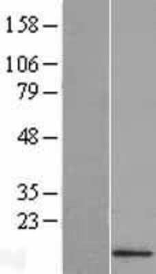 Western Blot: IFI27L2 Overexpression Lysate [NBL1-10480]