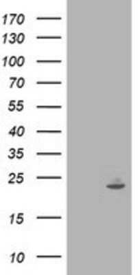 Western Blot: IFI35 Antibody (OTI1C9) [NBP2-01108]