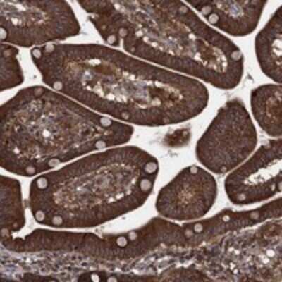 Immunohistochemistry-Paraffin: IFI35 Antibody [NBP3-17724]