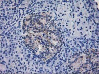 Immunohistochemistry: IFI35 Antibody (OTI1C9) - Azide and BSA Free [NBP2-71004]