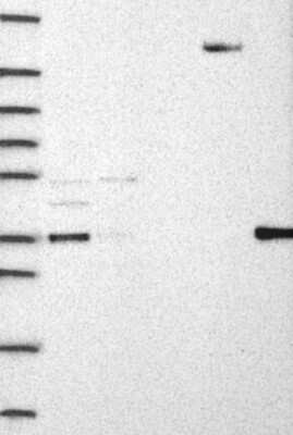 Western Blot: IFI35 Antibody [NBP3-17724]