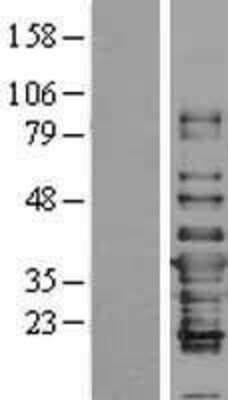 Western Blot: IFI35 Overexpression Lysate [NBL1-11829]