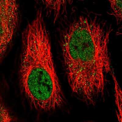 Immunocytochemistry/ Immunofluorescence: IFI44 Antibody [NBP2-55064]