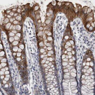 Immunohistochemistry: IFI44 Antibody [NBP1-82614]