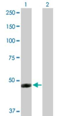 Western Blot: IFI44 Antibody [H00010561-D01P]