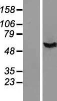 Western Blot: IFI44 Overexpression Lysate [NBL1-11830]