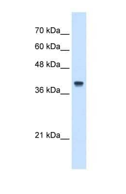 Western Blot: IFI44L Antibody [NBP1-57838]