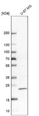 Western Blot: IFI44L Antibody [NBP2-38892]