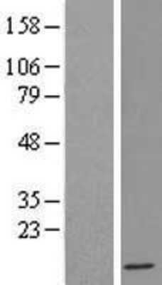 Western Blot: IFI6 Overexpression Lysate [NBL1-11832]