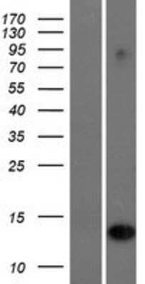 Western Blot: IFI6 Overexpression Lysate [NBP2-09907]