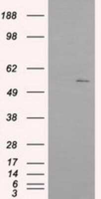 Western Blot: IFIT1 Antibody (OTI3G8) [NBP2-02340]