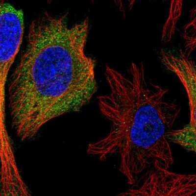 Immunocytochemistry/ Immunofluorescence: IFIT1 Antibody [NBP2-33751]