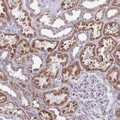 Immunohistochemistry-Paraffin: IFIT1 Antibody [NBP2-33751]