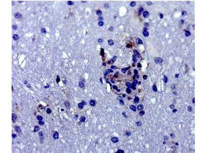 Immunohistochemistry-Paraffin: IFIT1 Antibody [NBP2-33751]