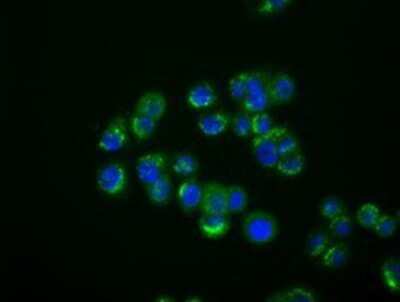 Immunocytochemistry/ Immunofluorescence: IFIT1 Antibody (OTI3G8) - Azide and BSA Free [NBP2-71005]