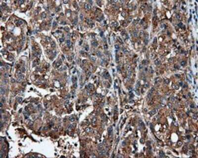 Immunohistochemistry: IFIT1 Antibody (OTI3G8) - Azide and BSA Free [NBP2-71005]