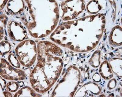 Immunohistochemistry: IFIT1 Antibody (OTI3G8) - Azide and BSA Free [NBP2-71005]