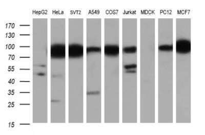 Western Blot: IFIT1 Antibody (OTI3G8)Azide and BSA Free [NBP2-71005]