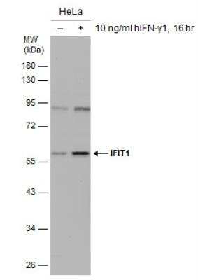 Western Blot: IFIT1 Antibody [NBP2-16921]