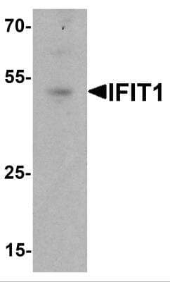 Western Blot: IFIT1 AntibodyBSA Free [NBP2-81823]