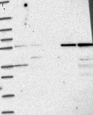 Western Blot: IFIT1 Antibody [NBP3-17870]