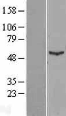 Western Blot: IFIT1 Overexpression Lysate [NBL1-11834]