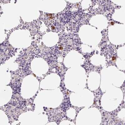 Immunohistochemistry: IFIT1B Antibody [NBP2-38978]