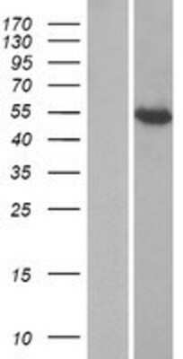 Western Blot: IFIT1B Overexpression Lysate [NBP2-08779]