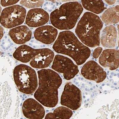 Immunohistochemistry-Paraffin: IFIT2 Antibody [NBP1-85617]