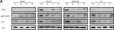 Western Blot: IFIT2 Antibody [NBP1-31164]