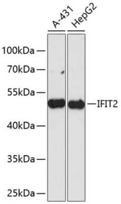 Western Blot: IFIT2 AntibodyAzide and BSA Free [NBP3-04917]