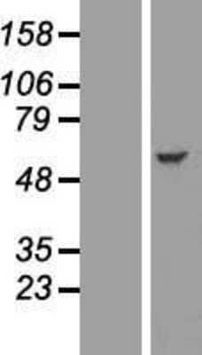 Western Blot: IFIT2 Overexpression Lysate [NBL1-11835]